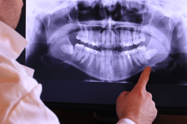 Best Emergency Root Canal Treatment in Goldsby, OK