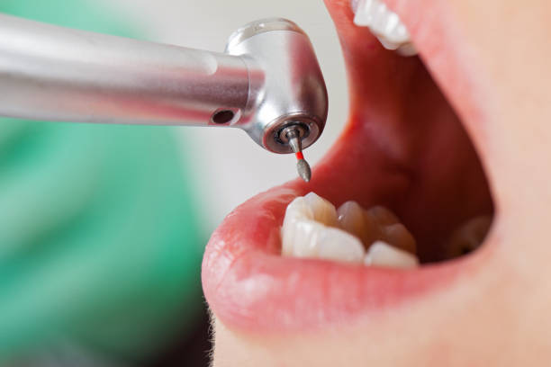 Best Pediatric Emergency Dentist in Goldsby, OK